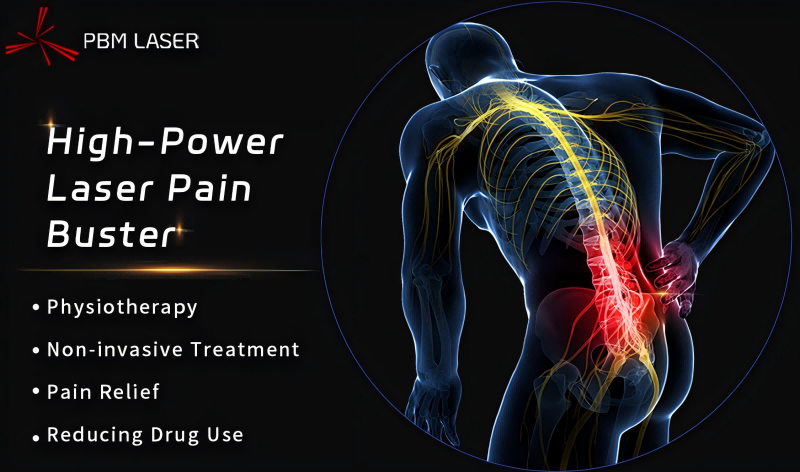 PBM Medical Laser Reserans Rehabilitationem Codicis, Summus Potestas Laser accipit Grade Commendatio in Sinarum Chronico Humilis Back Dolor Diagnosis et Curatio Praeceptionis (2024 Edition)