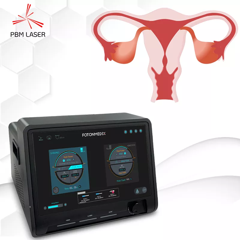 Laser Gynaecology Surgery